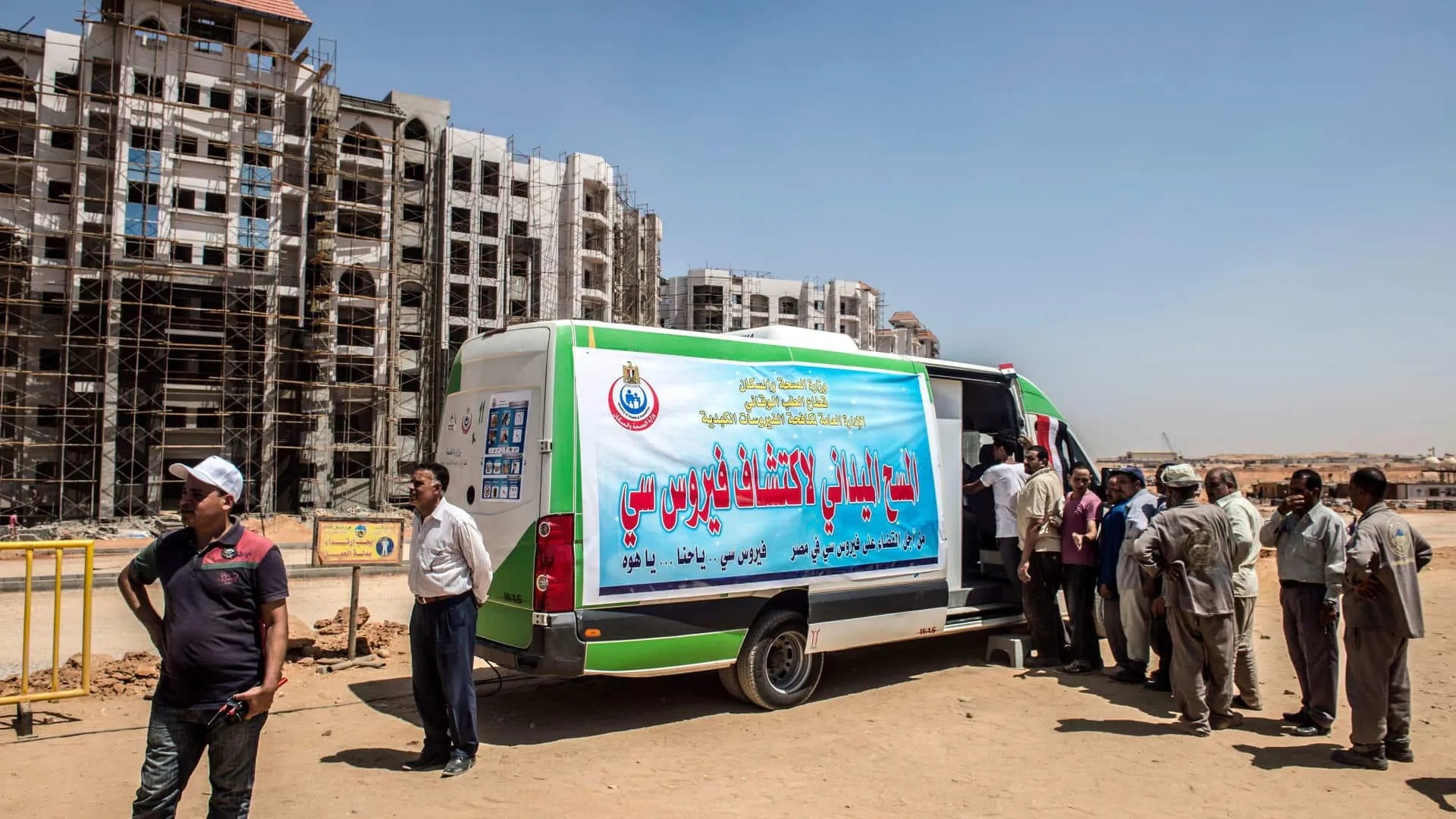 مصر لم تكن تضم 7% من المصابين بفيروس سي في العالم في 2015